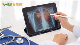 「幾乎一半病患來檢查時就診斷出是晚期肺癌，甚至已經轉移。」事實上，肺癌不僅早期症狀不明顯，等到有症狀時往往已是晚期，尤其一旦轉移就已是第四期。