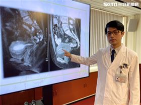 女罹子宮內膜癌　免摘子宮痊癒還生下寶寶（圖／翻攝畫面）