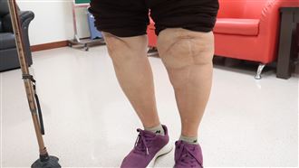 她長年跪地雙膝報廢 靠「1招」終於能走了