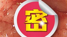 ▲患者的盲腸有像鵝卵石般的多發性病兆。（圖／臉書　胃腸專家 葉秉威醫師）