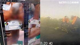 老翁被野狗咬到傷重睪丸外露，院方緊急縫合撿回一命。（圖／翻攝畫面）