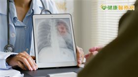 免疫治療相對標靶效果上通常較侷限，但在合併抗血管新生標靶後，發現針對肺腺癌，治療成績十分不錯。