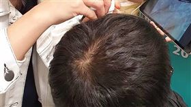 智能檢測系統 200倍影像掌握問題頭皮南台科大團隊研發出「智能頭皮膚質檢測系統」並現場展示，成員透過頭皮檢測儀拍下放大200倍頭皮影像，並傳回雲端伺服器進行判斷。（團隊提供）中央社記者蘇思云傳真　109年10月18日