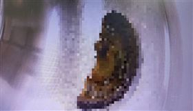 40歲男肚脹氣！醫師傻眼⋯小腸卡「這物」