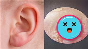 21歲尼泊爾女子 耳道有蜱蟲（圖／翻攝自醫療病例報告期刊、pixabay）