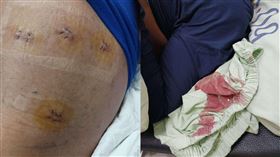 鄰居倒垃圾起口角，沒想到被亂刀桶傷。（圖／翻攝畫面）
