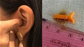 女子耳朵藏2公分樂高（圖／資料照、翻攝自鏡報）