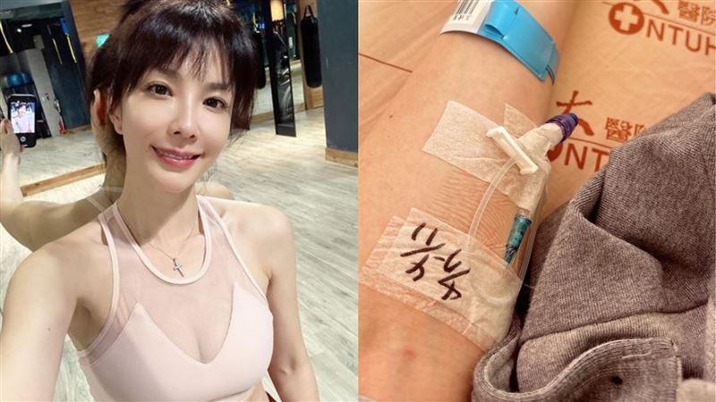 湘瑩新婚才滿月　腎臟長瘤恐爆裂動手術