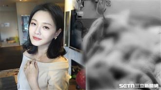 大S流感病逝　台大醫：肺炎是奪命殺手！