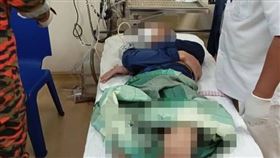 馬來西亞一名少年將戒指套在下體、拔不出來，最終送醫治療。（圖／翻攝自Bomba Alor Setar臉書）