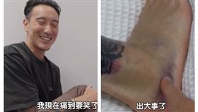 王陽明受傷（圖／翻攝自王陽明IG）
