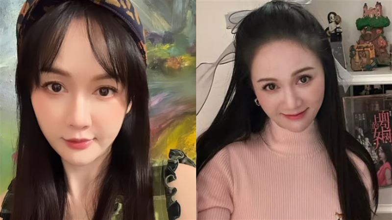 打電波臉腫被酸整形　陳喬恩曬消腫照反擊