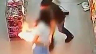 手機塞口袋瞬間爆炸　女子屁股著火畫面曝