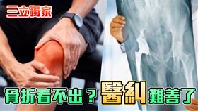 三立獨家-骨折看不出？醫糾難善了。（組合示意圖）