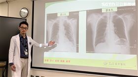 醫勸打疫苗不聽　養生男聚餐後染流感重症（圖／翻攝畫面）