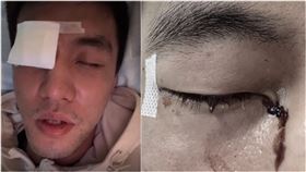 郭艾倫,中國,籃球,CBA,眼睛　翻攝自郭艾倫微博、抖音