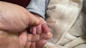2月大男嬰，指頭纏髮充血腫脹 醫：嚴重恐截肢，施勝桓醫師(圖／施勝桓醫師提供)