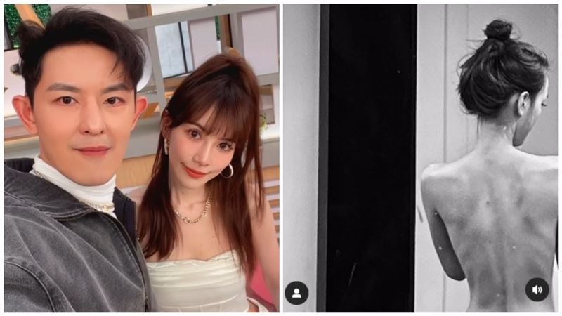 敖犬妻憂鬱「暴瘦剩36kg」：我會不會X掉