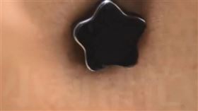 中國一名男子臉頰紅腫還能吸住磁鐵，竟是藏了小鋼珠。（圖／翻攝微博）