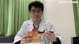 貴婦下午茶突褲底濕一片 醫：1半女生都會