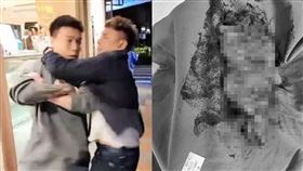 Tozy,超哥,台北地方法院,大腸癌,病理切片(圖/Toyz直播、超哥臉書)
