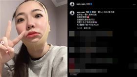 宛宛兒分享獨自北上動天鵝頸手術的術後正面照。（圖／翻攝自IG）