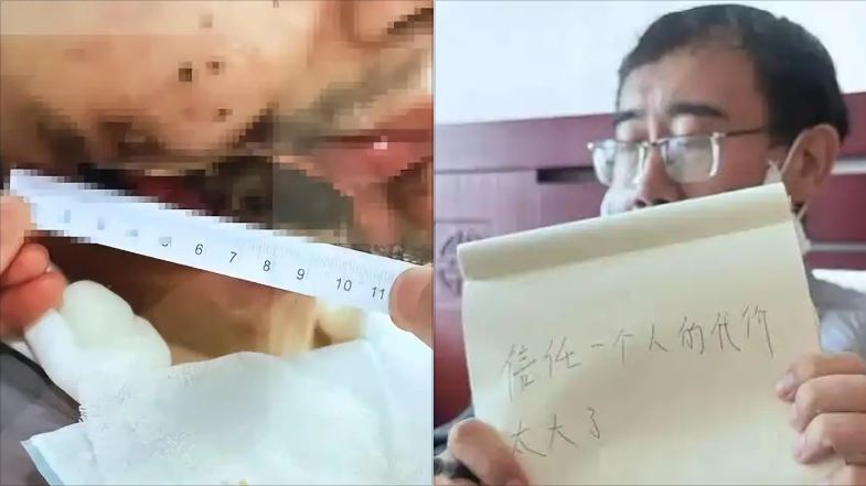 男罹口腔癌砸180萬看中醫「半張臉沒了」