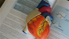 心臟移植　人工心臟　示意圖／pixabay