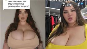 漢密爾頓因罹患巨乳症導致胸部持續增大，已對她的呼吸功能造成嚴重影響。（翻攝TikTok）