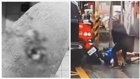  台北,比特犬,攻擊,蜂窩性組織炎,清創,手術