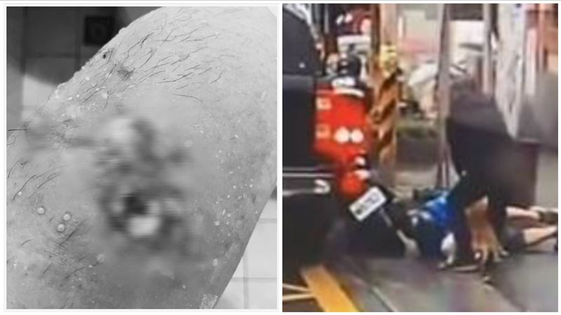 比特犬跳窗咬人　首位遭殃騎士現況曝光