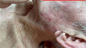 ▲蘇一峰的病人被看護暴打，他隔日上班得知隨即報警。（圖／蘇一峰臉書）

