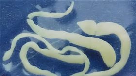 ▲裂頭蚴、曼氏裂頭絛蟲。（圖／翻攝自百度百科）

