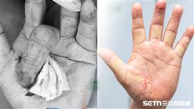 ▲妙手回春。（圖／彰基提供） 