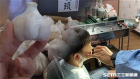 ▲蒜頭卡鼻子。（圖／南投醫院提供） 