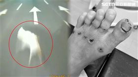 黃姓男騎士遭校狗逆向衝撞，人車倒地全身傷。（圖／民眾提供）