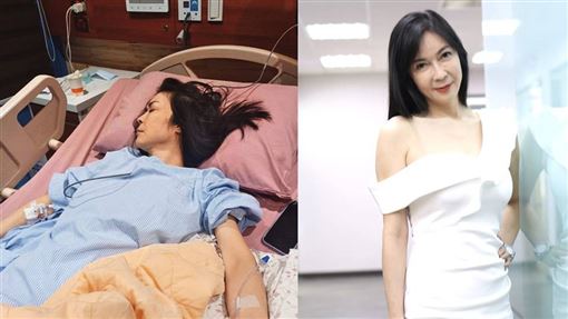 本土女星直腸癌4期　宣布做2高階療法續命