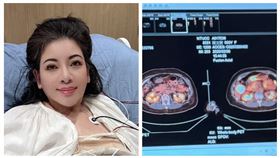 陳文茜曬出她的肝目前狀況（圖／翻攝臉書）