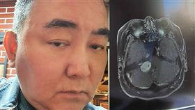 ▲徐亨病況讓人擔憂。（圖／翻攝自徐亨臉書）