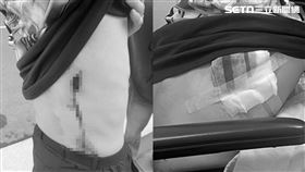 ▲韓籍大學生申城來在西門町遇刺。（圖／申城來授權提供，未經同意請勿轉載） 