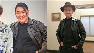 徐亨罹腦瘤胖到100公斤　醫曝3症狀恐罹病