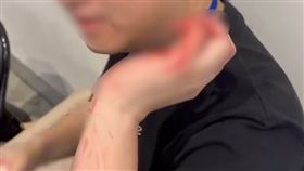 負責救援的工作人員也因此慘遭貓咪攻擊，整條手都是抓痕及鮮血。（圖／翻攝自毛怪樂園臉書）