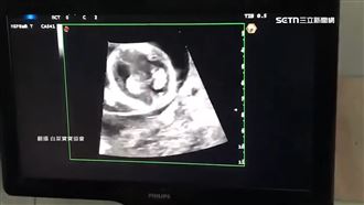 獨／砸百萬找代孕　協會踢皮球求子夢碎