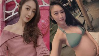 蔡允潔女兒放寒假　激曬背部全裸針灸畫面