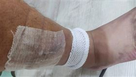 施先生的傷勢。（圖／翻攝畫面）