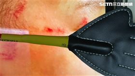 男童傷勢為「愛的小手」造成。（圖／家長提供） 