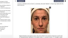 ▲肉毒桿菌有助改善減緩憂鬱症？！國際期刊toxin專文引全球醫美界重視。（圖／翻攝自國際期刊toxin官網）