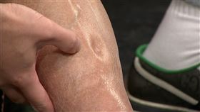 孔鏘坦言右腳不明腫脹2個月，非常擔心若被截肢就無法再彈琴了。（圖／年代提供）