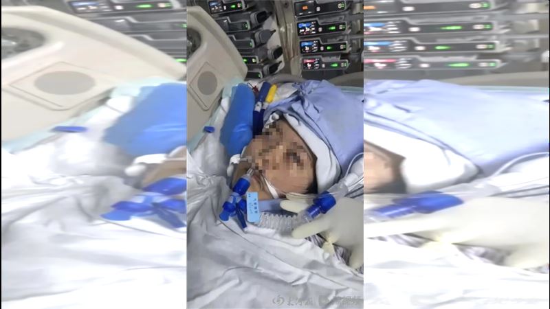 22歲女手術成功卻腦死　恢復室缺氧無人知