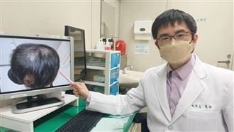 30歲男大掉髮以為雄性禿！醫一看驚呼梅毒